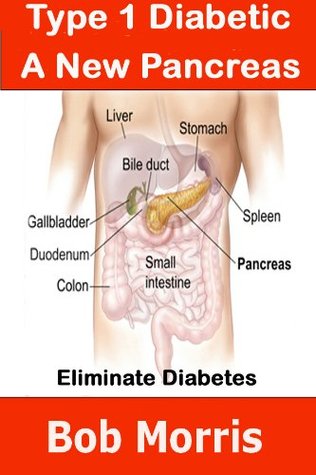 Full Download Type 1 Diabetic – A New Pancreas (Your Health) - Bob Morris | PDF