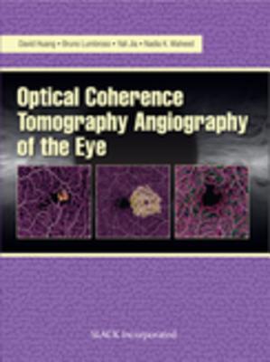 Full Download Optical Coherencre Tomography Angiography of the Eye - David Huang | PDF