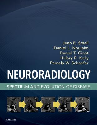 Full Download Neuroradiology: Spectrum and Evolution of Disease - Juan Small | ePub